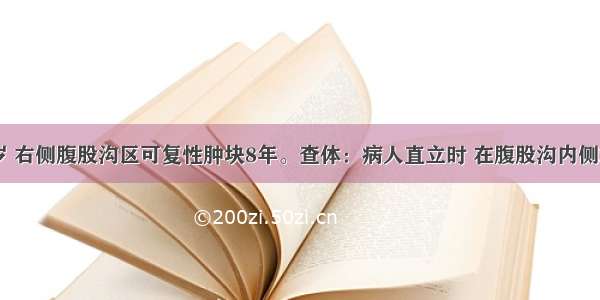 男性 74岁 右侧腹股沟区可复性肿块8年。查体：病人直立时 在腹股沟内侧端 耻骨结